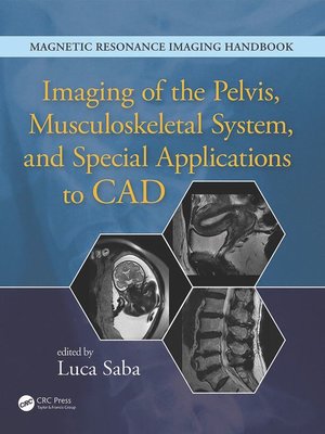 cover image of Imaging of the Pelvis, Musculoskeletal System, and Special Applications to CAD